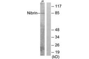 Western blot analysis of extracts from Jurkat cells, using Nibrin (Ab-278) Antibody. (Nibrin Antikörper  (AA 251-300))