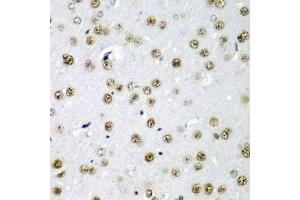 Immunohistochemistry of paraffin-embedded rat brain using SF3B3/S antibody (ABIN6128696, ABIN6147668, ABIN6147669 and ABIN6221751) at dilution of 1:200 (40x lens).