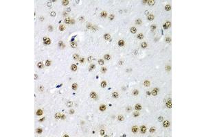 Immunohistochemistry of paraffin-embedded rat brain using SF3B3/S antibody (ABIN6128696, ABIN6147668, ABIN6147669 and ABIN6221751) at dilution of 1:200 (40x lens). (SF3B3 Antikörper  (AA 948-1217))
