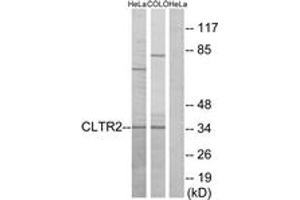 Western blot analysis of extracts from HeLa/COLO cells, using CLTR2 Antibody. (CasLTR2 Antikörper  (AA 281-330))