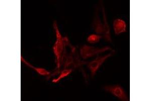ABIN6275480 staining NIH-3T3 cells by IF/ICC. (RGS14 Antikörper  (Internal Region))