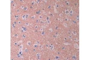 IHC-P analysis of brain tissue, with DAB staining. (CYP1A2 Antikörper  (AA 2-231))