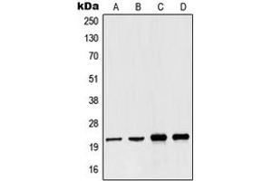 Western blot analysis of NDUFB10 expression in Jurkat (A), A431 (B), Raji (C), HepG2 (D) whole cell lysates. (NDUFB10 Antikörper  (Center))