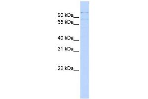 RBM12 antibody used at 1 ug/ml to detect target protein. (RBM12 Antikörper  (Middle Region))