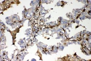 IHC analysis of S100A4 using anti-S100A4 antibody (ABIN7600462). (s100a4 Antikörper  (AA 2-101))