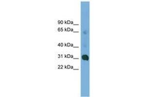Image no. 1 for anti-Coiled-Coil Domain Containing 127 (CCDC127) (AA 35-84) antibody (ABIN6745006) (CCDC127 Antikörper  (AA 35-84))