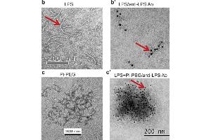 immunoelectron microscopy (IEM) images of LPS using ABIN479062. (Lipopolysaccharides (LPS) Antikörper)