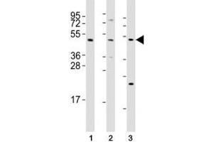 Western blot testing of Mlkl antibody at 1:2000 dilution and mouse samples: (1) testis, (2) liver, (3) NIH3T3 lysate; Predicted size: 54 kDa. (MLKL Antikörper  (AA 444-472))
