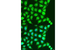 Immunofluorescence analysis of U2OS cells using UBIAD1 antibody (ABIN2737790) at dilution of 1:100. (UBIAD1 Antikörper)