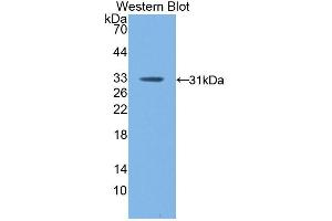 Western blot analysis of the recombinant protein. (F13A1 Antikörper  (AA 372-616))