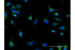 Immunofluorescence of purified MaxPab antibody to DIAPH1 on HeLa cell. (DIAPH1 Antikörper  (AA 1-404))