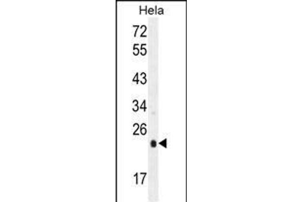 UQCRFS1 Antikörper  (C-Term)