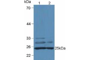 Western blot analysis of (1) Mouse Heart Tissue and (2) Mouse Liver Tissue. (C1QA Antikörper  (AA 23-245))