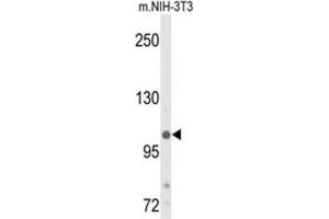 Western Blotting (WB) image for anti-Lysine (K)-Specific Demethylase 4B (KDM4B) antibody (ABIN3004253) (KDM4B Antikörper)