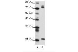 Image no. 1 for anti-SATB Homeobox 1 (SATB1) (AA 611-660) antibody (ABIN6736150) (SATB1 Antikörper  (AA 611-660))