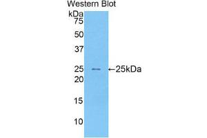 Western Blotting (WB) image for anti-Sialic Acid Binding Ig-Like Lectin 1, Sialoadhesin (SIGLEC1) (AA 34-240) antibody (ABIN1173999)