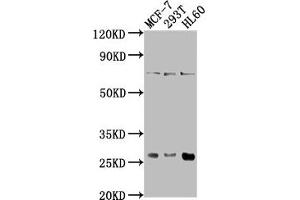 Western Blot Positive WB detected in: MCF-7 whole cell lysate, 293T whole cell lysate, HL60 whole cell lysate All lanes: STYX antibody at 1:1000 Secondary Goat polyclonal to rabbit IgG at 1/50000 dilution Predicted band size: 26 kDa Observed band size: 26 kDa (STYX Antikörper  (AA 1-223))