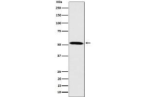 Western blot analysis of Fukutin expression in HeLa cell lysate.