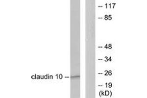 Western blot analysis of extracts from LOVO cells, using Claudin 10 Antibody. (CLDN10 Antikörper  (AA 179-228))