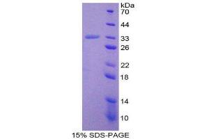 SDS-PAGE (SDS) image for Prostaglandin-Endoperoxide Synthase 1 (Prostaglandin G/H Synthase and Cyclooxygenase) (PTGS1) (AA 23-277) protein (His tag) (ABIN1878697)