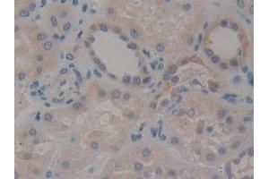 Immunohistochemistry (IHC) image for anti-Signal Transducer and Activator of Transcription 2, 113kDa (STAT2) (AA 616-849) antibody (ABIN7434083)