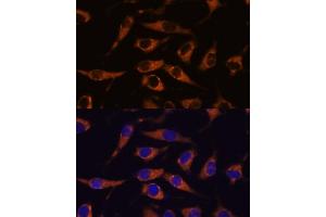 Immunofluorescence analysis of L929 cells using SM antibody (ABIN7270612) at dilution of 1:100. (SMAP1 Antikörper  (AA 180-250))