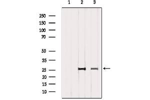 Western blot analysis of extracts from various samples, using CD81 Antibody. (CD81 Antikörper  (Internal Region))