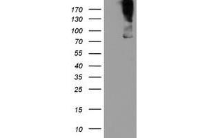 Western Blotting (WB) image for anti-Zinc Finger, BED-Type Containing 1 (ZBED1) antibody (ABIN1501794) (ZBED1 Antikörper)