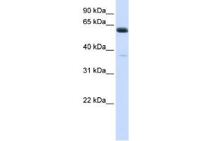 Human Heart; WB Suggested Anti-ALG6 Antibody Titration: 0. (ALG6 Antikörper  (N-Term))