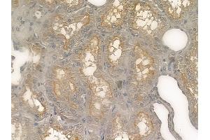ABIN6260779 and ABIN6273207 at 1/100 staining human normal kidney tissue by IHC-P. (CFHR3 Antikörper  (Internal Region))
