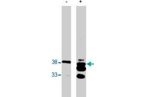 Western blot analysis using PPAP2B polyclonal antibody  on bacterially expressed PPAP2B protein when untreated (-) and treated with with 0. (PPAP2B Antikörper)