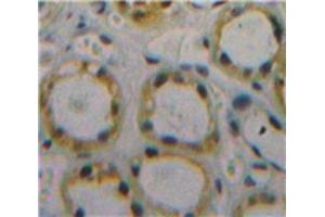 Used in DAB staining on fromalin fixed paraffin-embedded Kidney tissue (CD59 Antikörper  (AA 26-102))