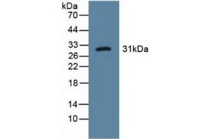 Detection of LOX1 in Human Urine using Polyclonal Antibody to Lectin Like Oxidized Low Density Lipoprotein Receptor 1 (LOX1) (OLR1 Antikörper  (AA 81-273))