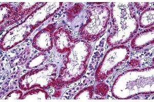 Human Kidney: Formalin-Fixed, Paraffin-Embedded (FFPE) (Retinol Binding Protein 5 Antikörper  (AA 10-59))