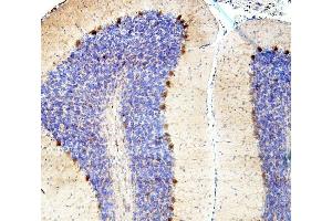 IHC analysis of SMAD2 using anti-SMAD2 antibody (ABIN6719361). (SMAD2 Antikörper  (AA 83-264))