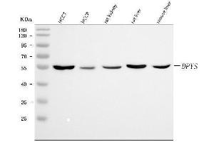 Western blot analysis of DPYS using anti-DPYS antibody (ABIN7599618).