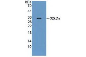 Detection of Recombinant PTPRQ, Human using Polyclonal Antibody to Protein Tyrosine Phosphatase Receptor Type Q (PTPRQ) (PTPRQ Antikörper  (AA 36-294))