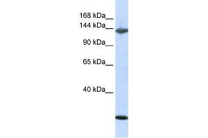 Western Blotting (WB) image for anti-Jagged 2 (JAG2) antibody (ABIN2458924) (JAG2 Antikörper)