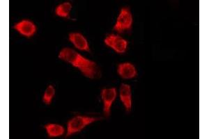 ABIN6278603 staining HeLa by IF/ICC. (OR1D4/5 Antikörper)