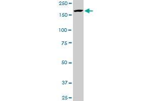 KDM5B monoclonal antibody (M02A), clone 1G10. (KDM5B Antikörper  (AA 231-319))