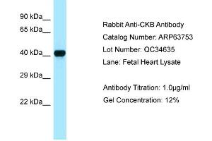 Western Blotting (WB) image for anti-Creatine Kinase, Brain (CKB) (C-Term) antibody (ABIN970402) (CKB Antikörper  (C-Term))