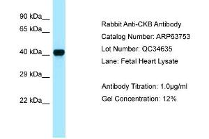 Western Blotting (WB) image for anti-Creatine Kinase, Brain (CKB) (C-Term) antibody (ABIN2789613) (CKB Antikörper  (C-Term))