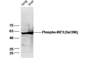 IRF3 Antikörper  (pSer396)