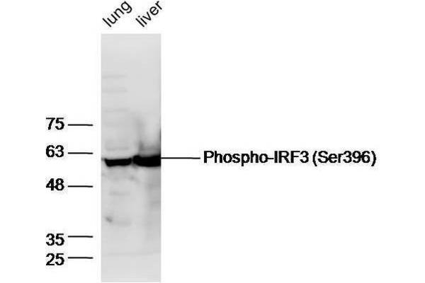 IRF3 Antikörper  (pSer396)