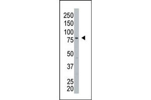 Image no. 1 for anti-Glycosylphosphatidylinositol Specific phospholipase D1 (GPLD1) (C-Term) antibody (ABIN357724) (GPLD1 Antikörper  (C-Term))