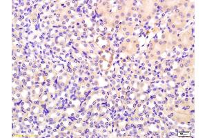 Formalin-fixed and paraffin embedded mouse kidney labeled with Rabbit Anti FGF1/AFGF Polyclonal Antibody, Unconjugated (ABIN726590) at 1:200 followed by conjugation to the secondary antibody and DAB staining