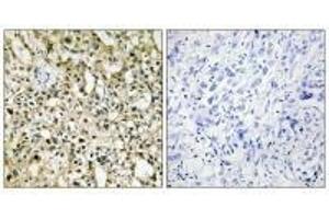 Immunohistochemistry (IHC) image for anti-Myc Proto-Oncogene protein (MYC) (C-Term) antibody (ABIN7180209)