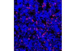 Immunofluorescence of paraffin embedded mouse bone using CSF1 (ABIN7073553) at dilution of 1:900 (400x lens) (M-CSF/CSF1 Antikörper)