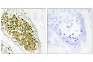 Immunohistochemistry analysis of paraffin-embedded human testis tissue using HIPK4 antibody. (HIPK4 Antikörper  (C-Term))