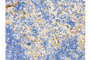 ABIN7094520 and ABIN7098569 at 1/100 staining Rat spleen tissue by IHC-P. (HTR7 Antikörper  (N-Term))